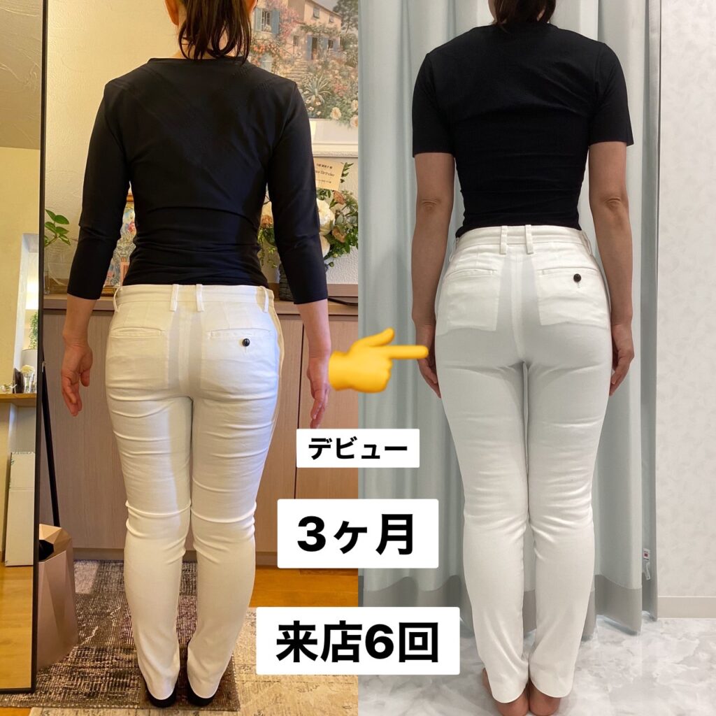 【Before＆After】運動・食事制限なし！下半身サイズダウンもedenにお任せ